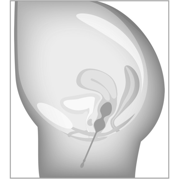 copy of SET DI 3 PALLINE VAGINALI