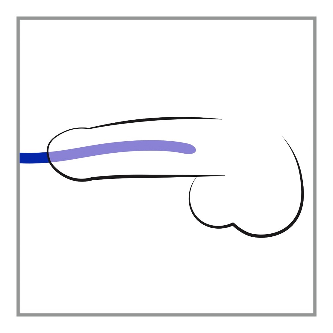 DILATATORI URETRALI SET 3 DIVERSE MISURE SILICONE