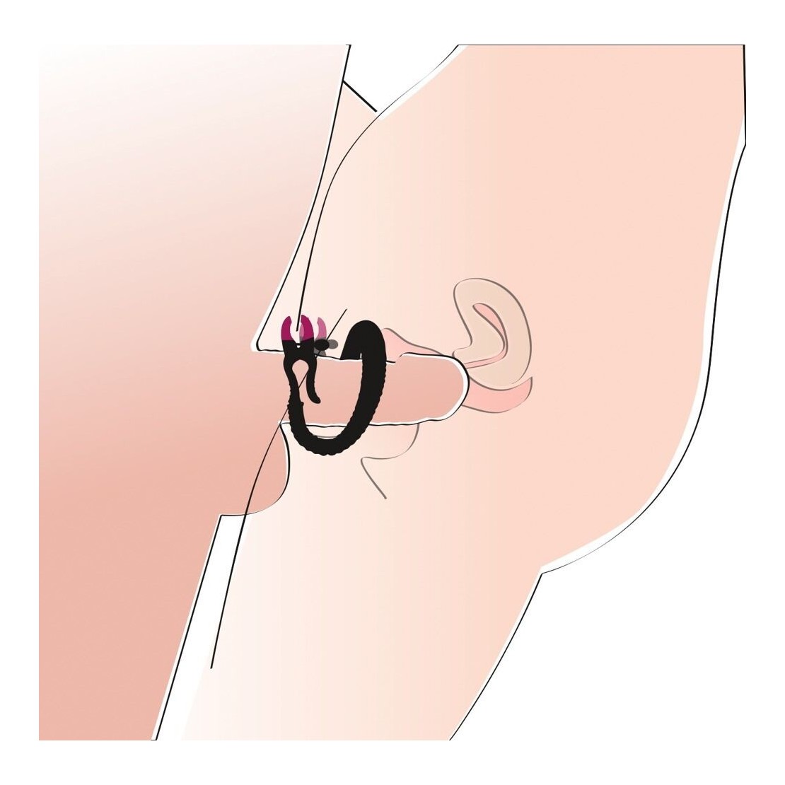 DUE PINZE CHE APRONO LE  LABBRA VAGINALI...