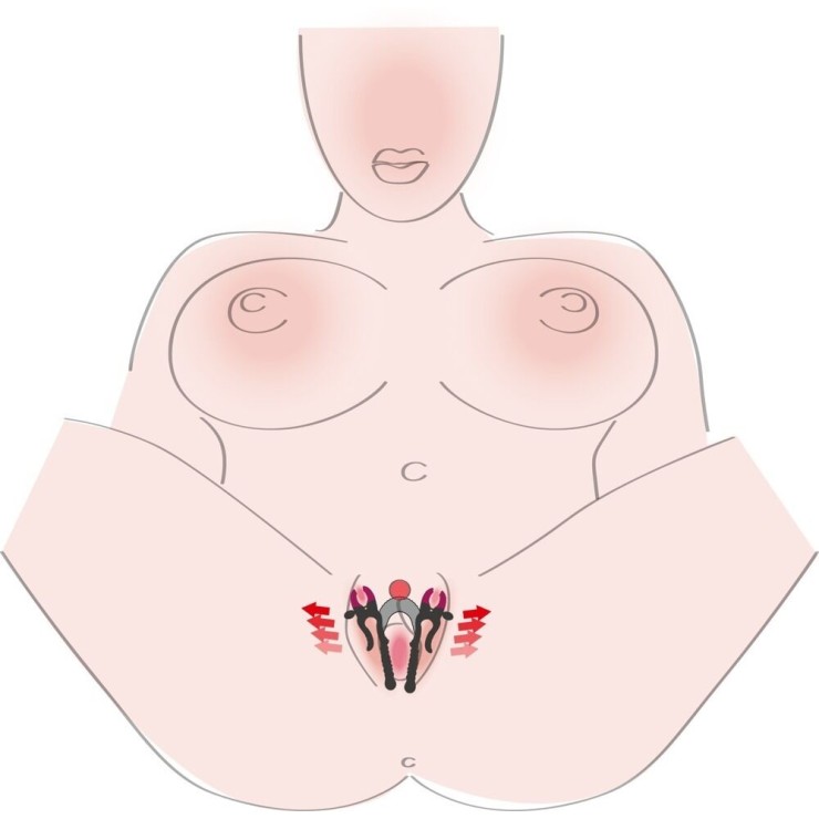 DUE PINZE CHE APRONO LE  LABBRA VAGINALI REGOLABILI SPREADER 2