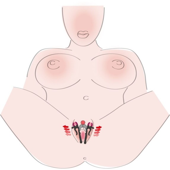 DUE PINZE CHE APRONO LE  LABBRA VAGINALI REGOLABILI SPREADER