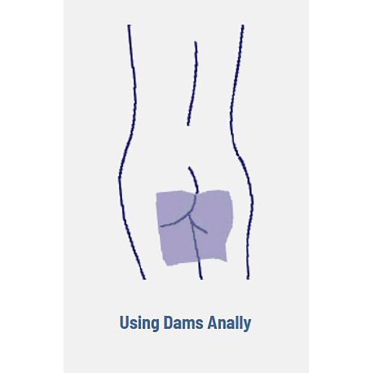 DAM PROFILATTICO 2